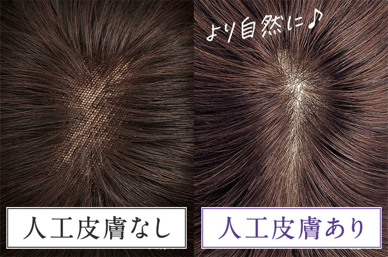 人工皮膚あり／なし